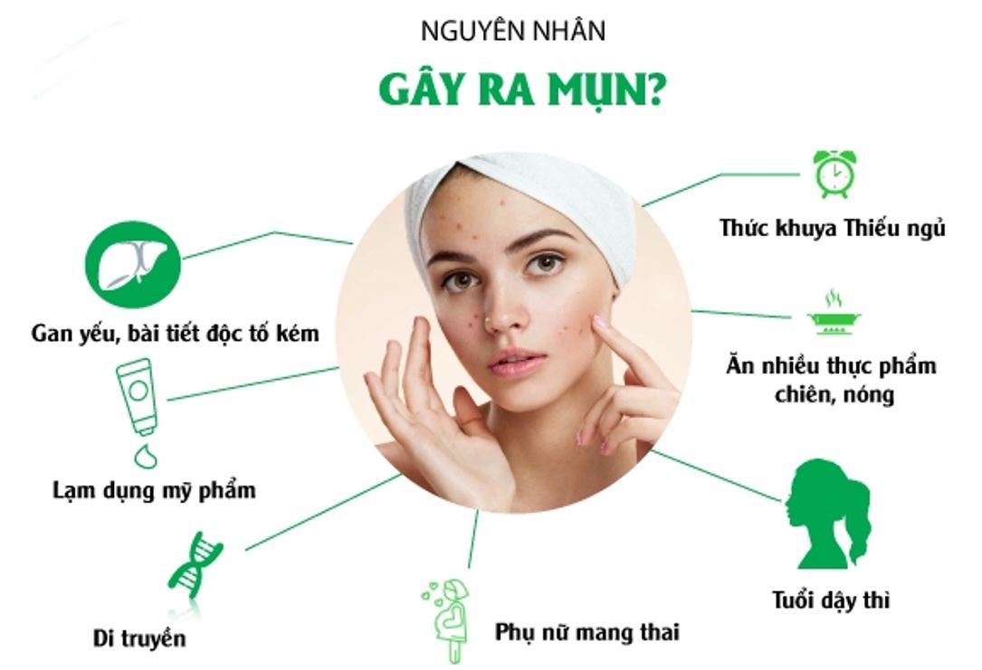 Trị mụn dậy thì Trị mụn dậy thì
